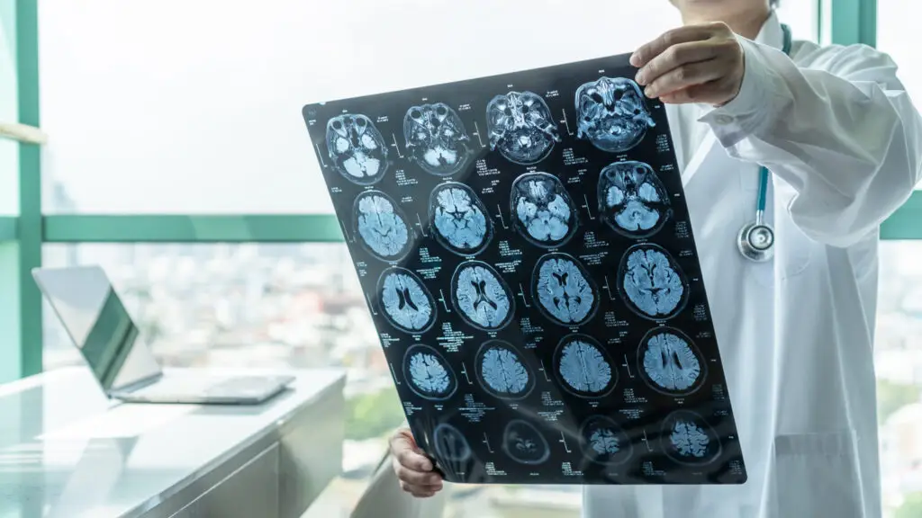 A doctor reviews the results of a brain scan. 