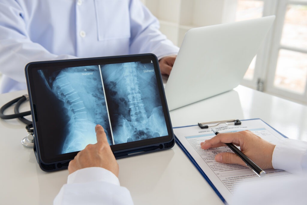 A doctor reviews imaging to determine the extent of nerve damage after a car accident. 